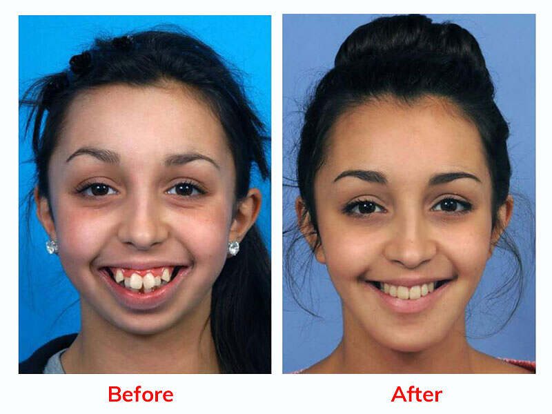 خدمات جراحة التجميل من همين تور