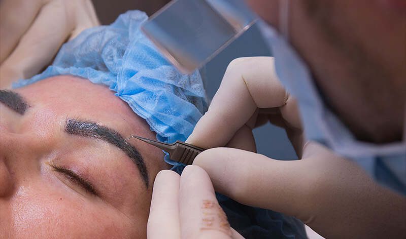 زراعة الحواجب الطبيعية في إيران