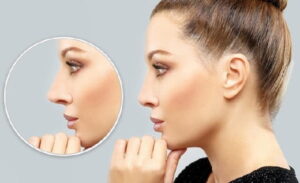 نصائح ما قبل عملية تجميل الانف