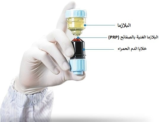 حقن البلازما الغنية بالصفائح في إيران مع همينتور: بشرة نضرة وشعر كثيف