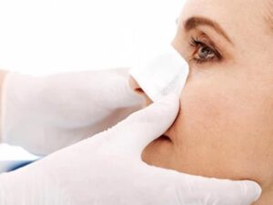 عملية تجميل الأنف في إيران: الوقت المثالي لتحقيق مظهرك المثالي