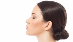 تجميل الذقن في ايران