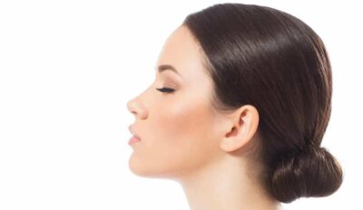 تجميل الذقن في ايران