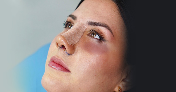 كدمات عملية تجميل الأنف: الأسباب، المناطق، والتعافي مع "همینتور"