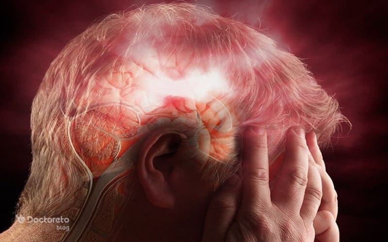 السياحة الطبية في إيران: دليل شامل عن آمبولي الدماغ مع هيمينتور