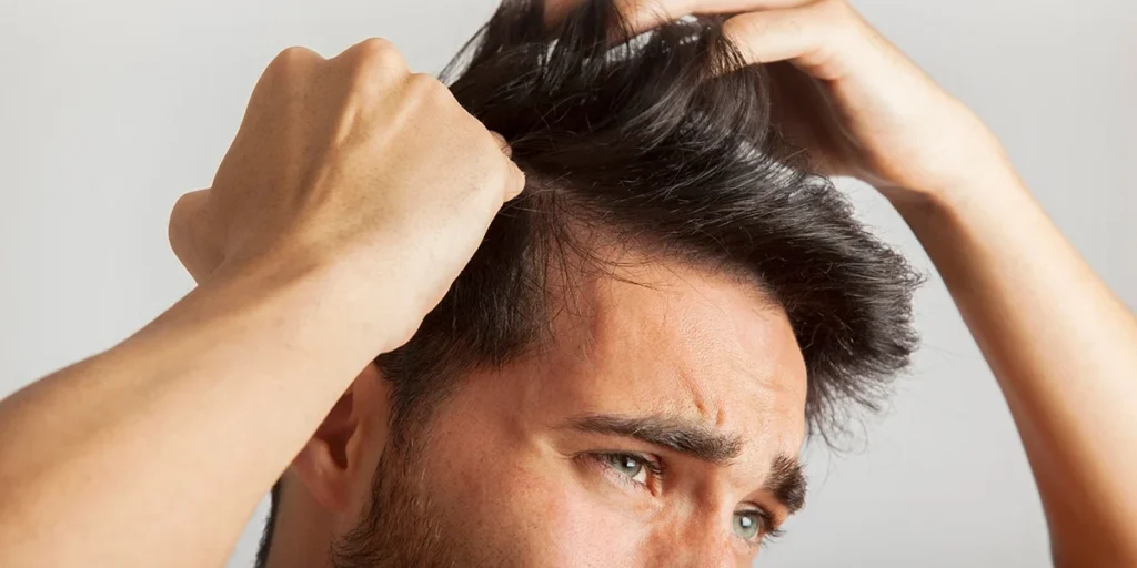 الأخطاء الشائعة قبل زراعة الشعر التي يجب معرفتها