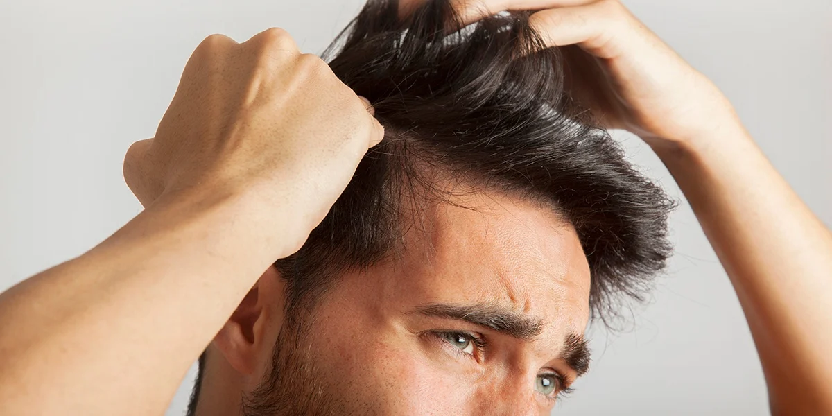 الأخطاء الشائعة قبل زراعة الشعر التي يجب معرفتها