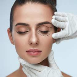 Eyelid Surgery Preparation | A Step-by-Step Guide
