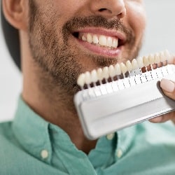 Dental Veneers Guide: Achieve Your Perfect Smile