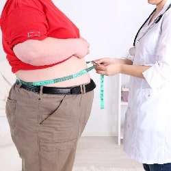 Frequently asked questions about gastric bypass