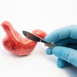 7 Essential Facts About Gastric Sleeve Surgery in 2025