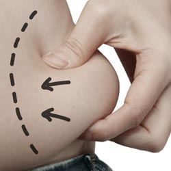 HOW MUCH WEIGHT CAN I LOSE WITH LIPOSUCTION?