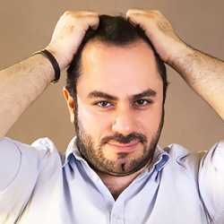 Complete Guide to Preventing and Treating Hair Loss
