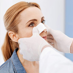 Essential Recovery Tips for a Smooth Rhinoplasty Journey