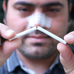 Is It OK to Smoke After Rhinoplasty?