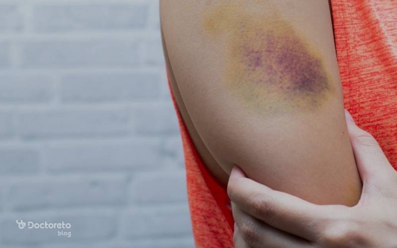 السياحة الطبية في إيران: دليل شامل عن الهيماتوم مع هيمينتور