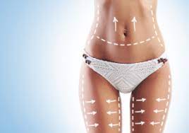 Liposuction vs. Lipomatic: