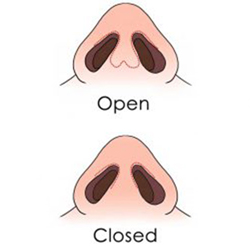 open-closed-rhinoplasty-featured