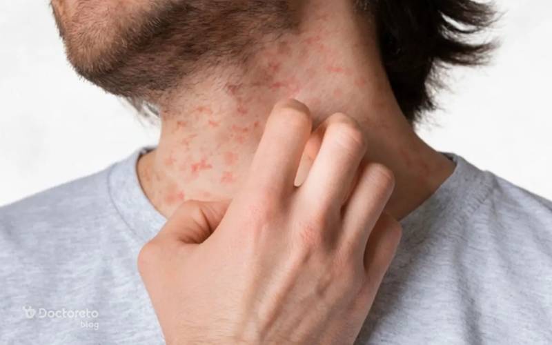 السياحة الطبية في إيران: دليل شامل عن الواسكوليت مع هيمينتور