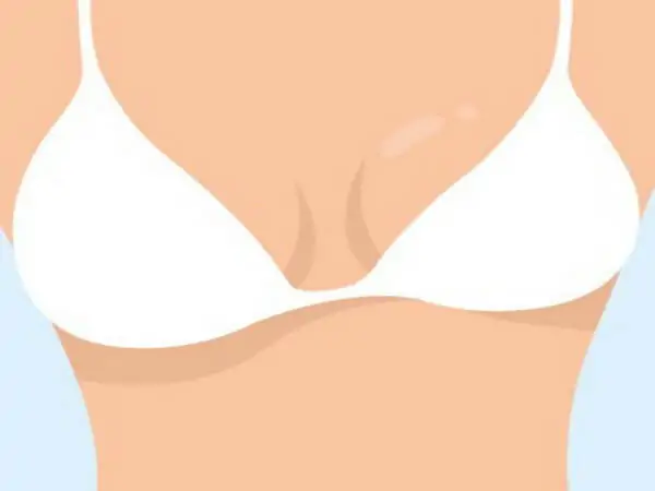 اختلاف حجم الثدي: دليل شامل حول الأسباب، التشخيص، والعلاج في إيران