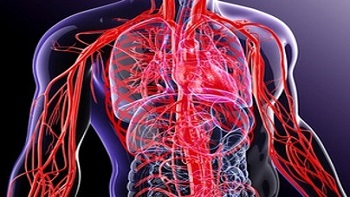 Angiography in Iran: Affordable Vascular Diagnosis