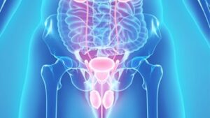 Bladder Cancer Treatment