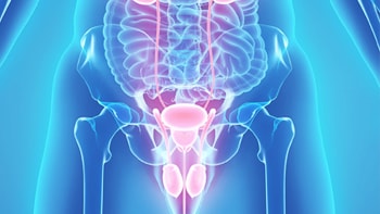 Bladder Cancer Treatment