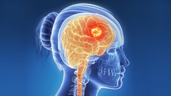 Brain Cancer Treatment
