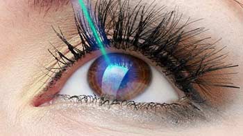 Advanced Corneal Transplant Solutions in Iran