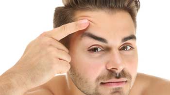 Lid Deformity Surgery
