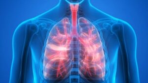 Lung Cancer Treatment