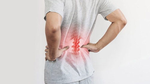 Laminectomy in Iran: Affordable Back Pain Relief