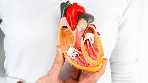 Heart Transplant Surgery in Iran: Affordable and Expert Care