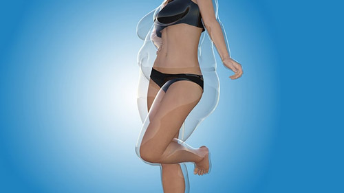 Transform Your Body with Lipomatic Surgery in Iran