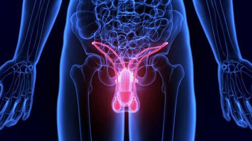 Premier Penile Enhancement Solutions in Iran