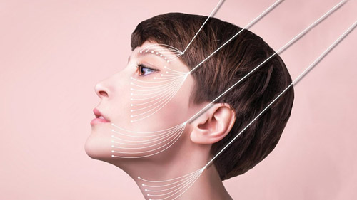 Rejuvenate Your Appearance with Thread Lift in Iran