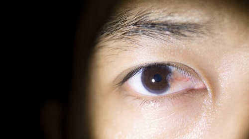 Restore Your Vision and Confidence with Pterygium Surgery in Iran