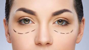 Puffy Eyelids Surgery in Iran