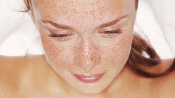 Skin Cancer Treatment