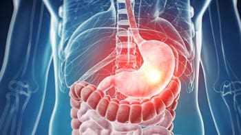 Iran's Premier Stomach Cancer Care