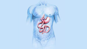 Comprehensive Guide to Abdominal Surgery in Iran: Precision and Recovery