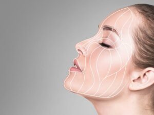 Facial Contouring Filler Injections in Iran: Affordable Sculpted Beauty