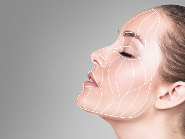 Facial Contouring Filler Injections in Iran: Affordable Sculpted Beauty