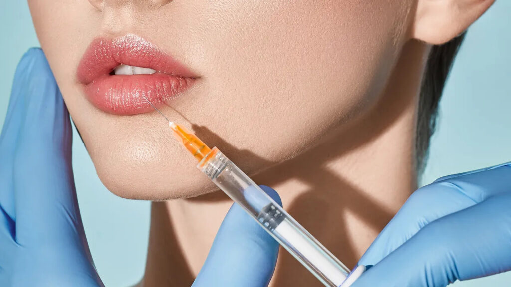 Lip Fillers in Iran: Affordable Beauty Boost