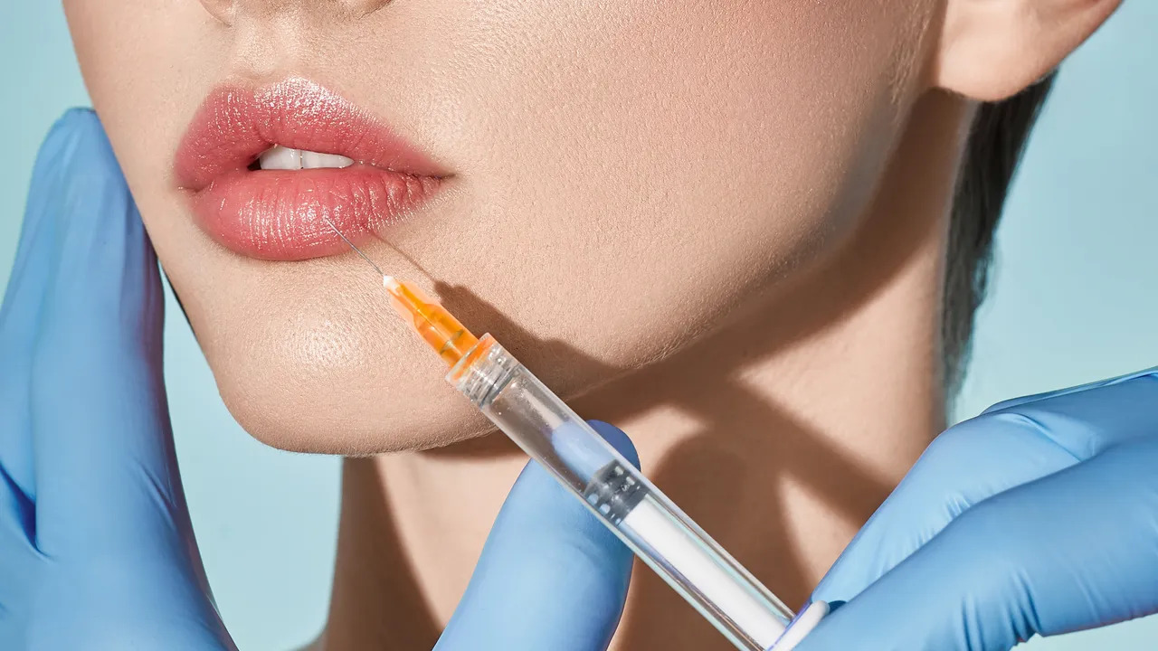 Lip Fillers in Iran: Affordable Beauty Boost