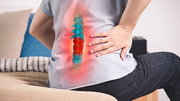 Herniated Disc Surgery in Iran: Affordable Back Pain Relief