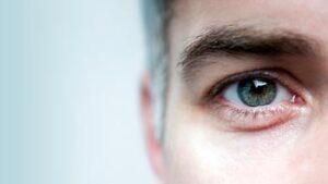 Complete Guide to Endoscopic DCR in Iran: Clear Vision, Restored Comfort