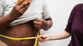 Comprehensive Guide to Gastric Balloon Procedure in Iran
