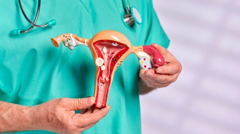 Treatment of prolapsed uterus and bladder in Iran