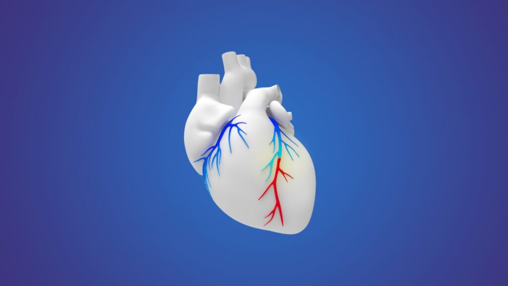 Heart Bypass Surgery in Iran: Affordable Life-Saving Treatment